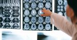 découvrez l'importance d'une évaluation de la santé pour améliorer votre bien-être général. informez-vous sur les outils et méthodes utilisés pour évaluer votre état de santé et prendre des décisions éclairées pour votre avenir.