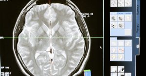 découvrez comment une évaluation de santé complète permet d’analyser votre état physique, de prévenir les maladies et d’optimiser votre bien-être au quotidien. informations et conseils par des experts santé.
